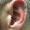 Auricoloterapia. Riflessologia dell orecchio con semini di vaccaria