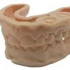 modello dentale in resina