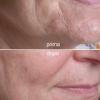 Radiance Face Massage