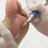 Pedicurista Callista Anna Estetica Charming