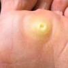 Pedicurista Callista Anna Estetica Charming