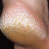 Pedicurista Callista Anna Estetica Charming