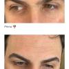 Pulizie ciglia uomo prima e dopo