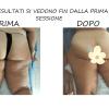 drenolinfatico