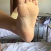 Prima CALLUS PEELING 